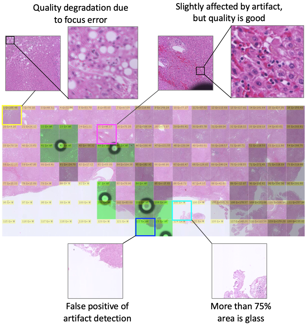 Automatic quality evaluation of whole slide images for the practical use of whole slide imaging scanner