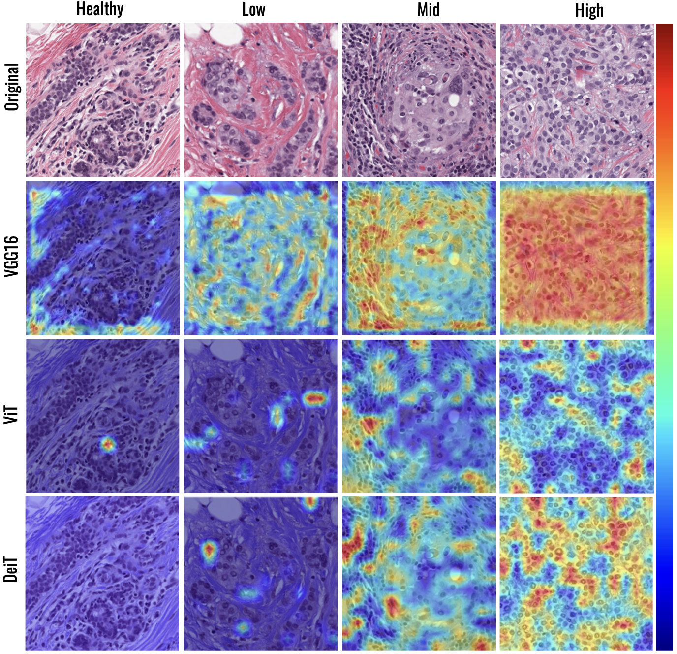 Residual Tumor Cellularity Assessment of Breast Cancer after Neoadjuvant Therapy using Image Transformer