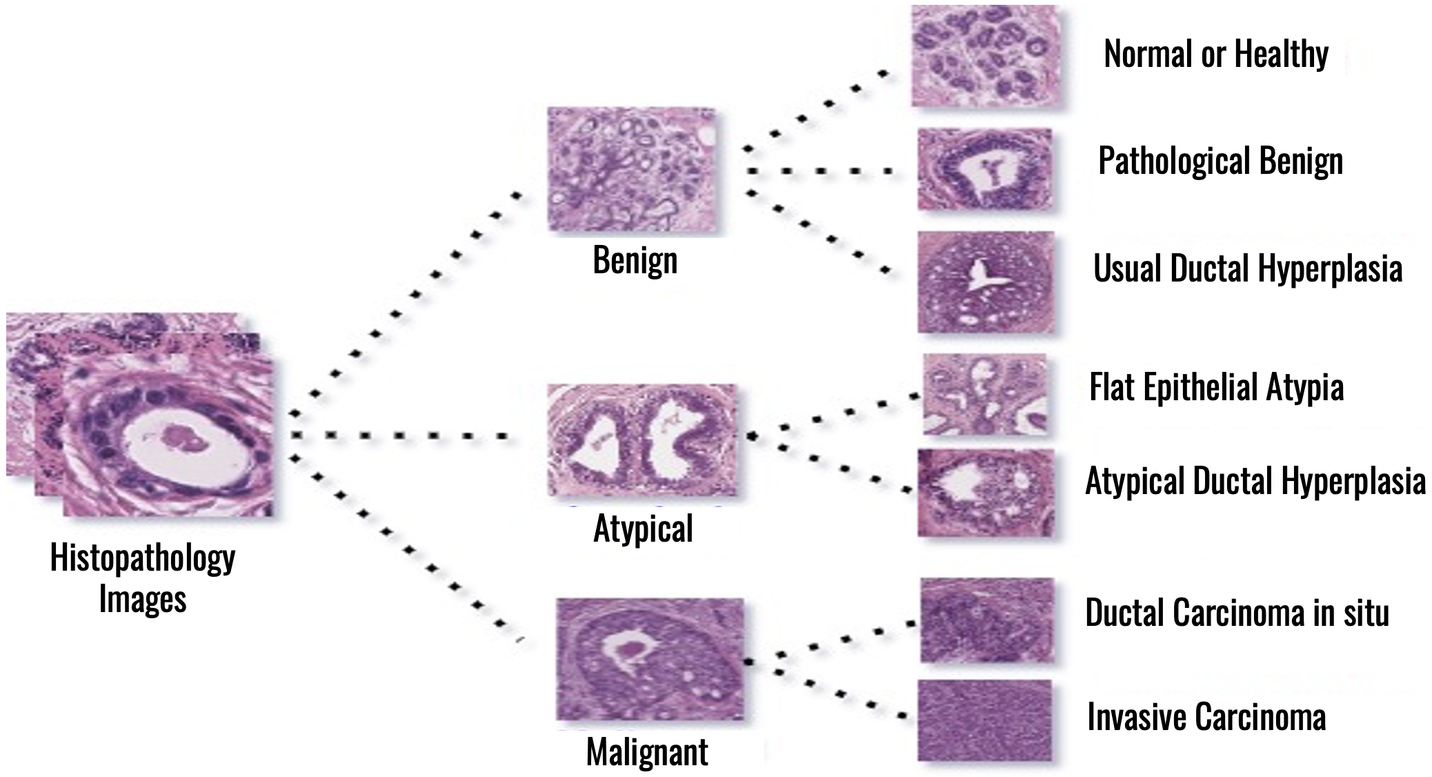 Vision Transformer for the Categorization of Breast Cancer from H&E Histopathology Images
