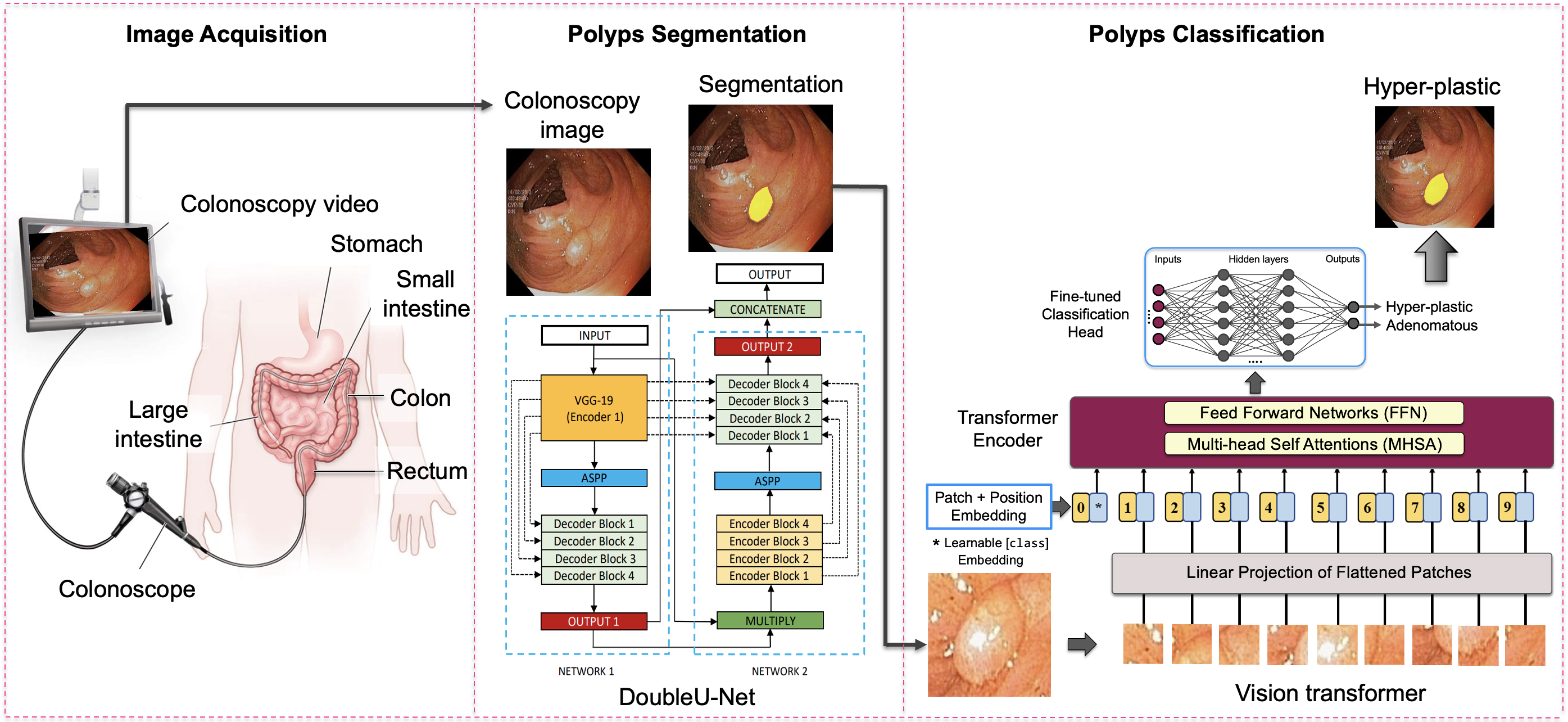 DeepPoly: deep learning-based polyps segmentation and classification for autonomous colonoscopy examination