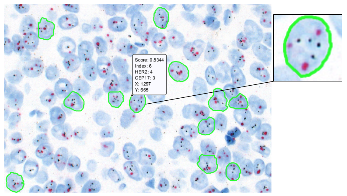 Automatic quantification of HER2 gene amplification in invasive breast cancer from chromogenic in situ hybridization whole slide images